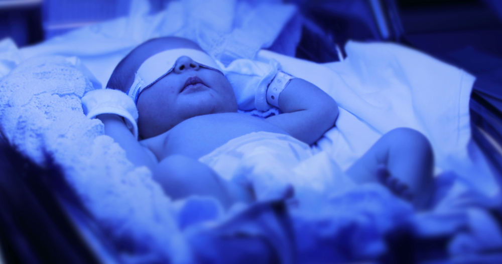 Is Phototherapy Safe for Newborn Babies